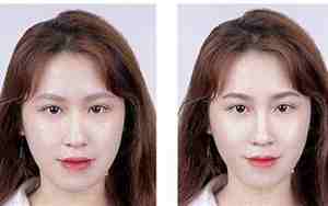 女人鼻梁有斑会影响财运吗