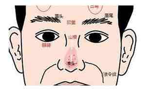 面相日角有黑斑好不好