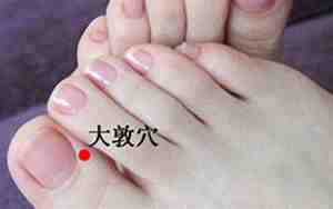 大敦放血可以去肝火吗