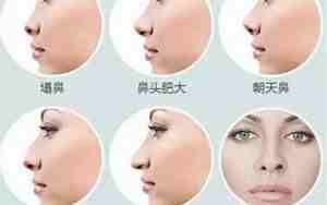 鼻子厚重的面相女人命运
