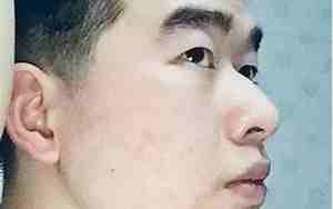 山根低男人面相图